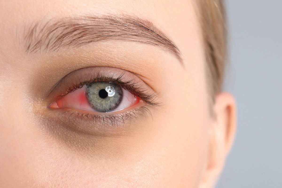 Trockene Augen was tun? Die besten Tipps für gesunde Augen